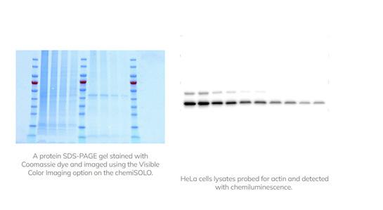 51CS1000_chemiSOLO-SDS_PAGE-Chemilumineszenz