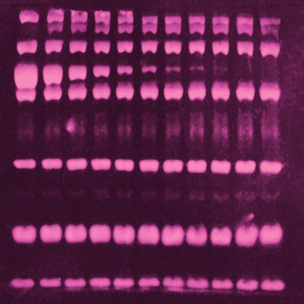 Artikelbild 1 des Artikels SYPRO Ruby Protein Blot Farbstoff